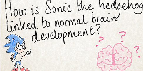 Sonic the Headhog and the Brain presentation slide